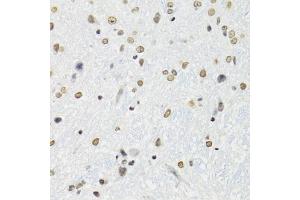 Immunohistochemistry of paraffin-embedded mouse brain using SFPQ antibody (ABIN5970351) at dilution of 1/100 (40x lens). (SFPQ antibody)