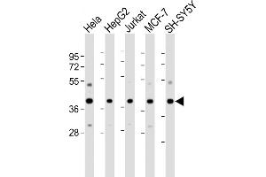 All lanes : Anti-RAE1 Antibody (N-Term) at 1:2000-1:4000 dilution Lane 1: Hela whole cell lysate Lane 2: HepG2 whole cell lysate Lane 3: Jurkat whole cell lysate Lane 4: MCF-7 whole cell lysate Lane 5: SH-SY5Y whole cell lysate Lysates/proteins at 20 μg per lane. (RAE1 antibody  (AA 19-42))