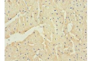 Immunohistochemistry of paraffin-embedded human heart tissue using ABIN7171931 at dilution of 1:100 (TTC32 antibody  (AA 1-151))