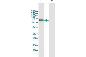 Western Blot analysis of XRCC4 expression in transfected 293T cell line by XRCC4 MaxPab polyclonal antibody. (XRCC4 antibody  (AA 1-336))