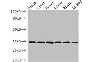 Western Blot Positive WB detected in: Rat brain tissue, Rat liver tissue, Mouse heart tissue, Mouse liver tissue, Mouse brain tissue, Mouse kidney tissue All lanes: MBP antibody at 4 μg/mL Secondary Goat polyclonal to rabbit IgG at 1/50000 dilution Predicted band size: 34, 22, 21, 19, 18 kDa Observed band size: 34 kDa (MBP antibody  (AA 1-197))