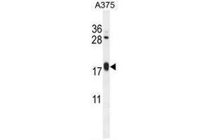 ARL8A Antibody (Center) western blot analysis in A375 cell line lysates (35µg/lane). (ARL8A antibody  (Middle Region))