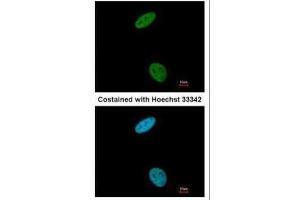 ICC/IF Image Immunofluorescence analysis of paraformaldehyde-fixed HeLa, using CDK6, antibody at 1:200 dilution. (CDK6 antibody)