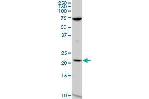 LCN1 polyclonal antibody (A01), Lot # 060814QCS1. (Lipocalin 1 antibody  (AA 24-120))
