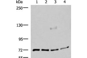Western blot analysis of A549 A172 TM4 and PC3 cell lysates using ASTE1 Polyclonal Antibody at dilution of 1:600 (ASTE1 antibody)