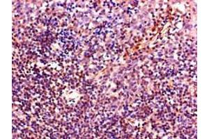 Immunohistochemistry of paraffin-embedded human tonsil tissue using ABIN7156914 at dilution of 1:100 (IL-4 antibody  (AA 25-153))