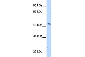 WB Suggested Anti-MAGEA1 Antibody Titration:  5. (MAGEA1 antibody  (C-Term))
