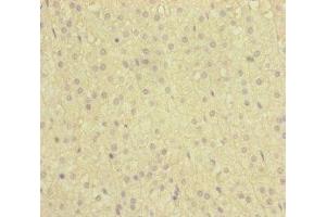 Immunohistochemistry of paraffin-embedded human adrenal gland tissue using ABIN7160738 at dilution of 1:100 (NAA25 antibody  (AA 703-972))
