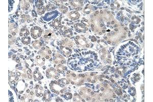 PPAT antibody was used for immunohistochemistry at a concentration of 4-8 ug/ml. (PPAT antibody  (N-Term))