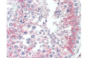 Anti-TCTE3 antibody IHC staining of human testis. (TCTE3 antibody  (N-Term))