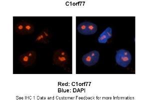 Immunohistochemistry (IHC) image for anti-Chromatin Target of PRMT1 (CHTOP) (Middle Region) antibody (ABIN2786135)