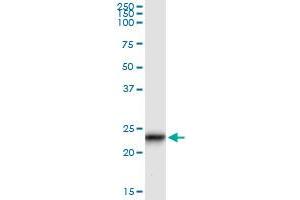 Immunoprecipitation of GUK1 transfected lysate using anti-GUK1 monoclonal antibody and Protein A Magnetic Bead , and immunoblotted with GUK1 MaxPab rabbit polyclonal antibody. (GUK1 antibody  (AA 100-197))