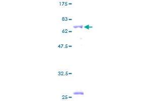 BCKDHB Protein (AA 1-392) (GST tag)