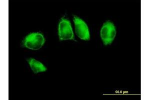 Immunofluorescence of purified MaxPab antibody to POR on HeLa cell. (POR antibody  (AA 1-680))