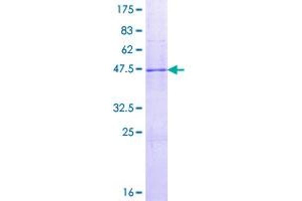 IL17D Protein (AA 1-202) (GST tag)