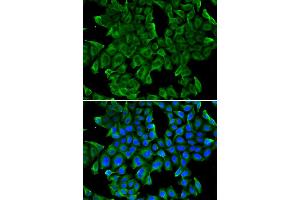 Immunofluorescence analysis of MCF-7 cells using REG3G antibody.