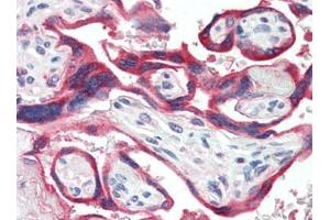 Human Placenta (formalin-fixed, paraffin-embedded) stained with GH1at 10 µg/ml followed by biotinylated goat anti-rabbit IgG secondary antibody, alkaline phosphatase-streptavidin and chromogen. (Growth Hormone 1 antibody)
