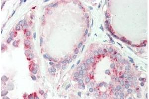 Haman, Thyroid: Foramlin-Fixed Paraffin-Embedded (FFPE) (GATAD1 antibody  (C-Term))