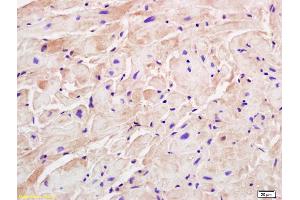 Formalin-fixed and paraffin embedded rat cardiac muscle labeled with Rabbit Anti M Cadherin Polyclonal Antibody, Unconjugated (ABIN719831) at 1:200 followed by conjugation to the secondary antibody and DAB staining (CDH15 antibody  (AA 355-450))