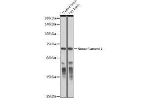 NEFL antibody