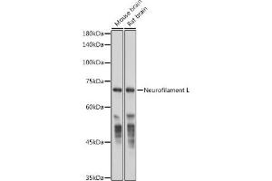 Western blot analysis of extracts of various cell lines, using Neurofilament L antibody (ABIN7268867) at 1:50000 dilution. (NEFL antibody)