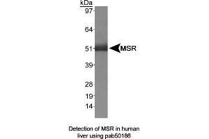 Image no. 1 for anti-Macrophage Scavenger Receptor 1 (MSR1) (AA 300-350) antibody (ABIN363495) (Macrophage Scavenger Receptor 1 antibody  (AA 300-350))