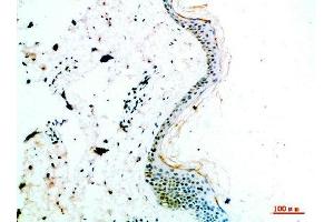Immunohistochemical analysis of paraffin-embedded human-skin, antibody was diluted at 1:200 (COL14A1 antibody  (AA 1571-1620))
