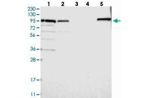 Western blot analysis of Lane 1: RT-4, Lane 2: U-251 MG, Lane 3: Human Plasma, Lane 4: Liver, Lane 5: Tonsil with RASA2 polyclonal antibody  at 1:250-1:500 dilution.