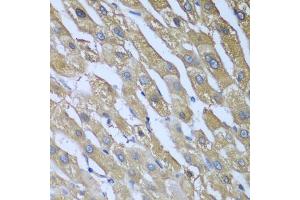 Immunohistochemistry of paraffin-embedded human liver using CAD antibody (ABIN5974557) at dilution of 1/100 (40x lens).