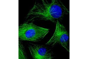 Immunofluorescent analysis of 4 % paraformaldehyde-fixed, 0. (TUBB2A antibody  (AA 14-46))