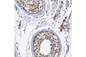 Immunohistochemical staining of human testis with ANKK1 polyclonal antibody  shows cytoplasmic positivity in cells in seminiferus ducts and leydig cells. (ANKK1 antibody)