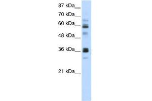 WB Suggested Anti-RPUSD2 Antibody Titration:  5.