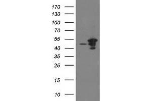 HEK293T cells were transfected with the pCMV6-ENTRY control (Left lane) or pCMV6-ENTRY ARFGAP1 (Right lane) cDNA for 48 hrs and lysed. (ARFGAP1 antibody)