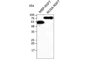 Western Blotting (WB) image for anti-SARS-CoV-2 Non-Structural Protein 7 (NSP7) antibody (ABIN7273019) (SARS-CoV-2 NSP7 antibody)