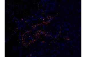 Immunofluoorescent l analysis of paraffin-embedded COVID-19 patient lung tissue using anti- SARS-CoV-2 (COVID-19) Envelope antibody (ABIN1031551, 2 μg/mL). (SARS-CoV-2 Envelope antibody  (N-Term))