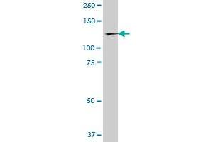UNC13D MaxPab polyclonal antibody. (UNC13D antibody  (AA 1-1090))