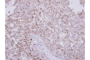 Image no. 1 for anti-Vitamin K-dependent protein C (PROC) (AA 1-236) antibody (ABIN1500426) (PROC antibody  (AA 1-236))