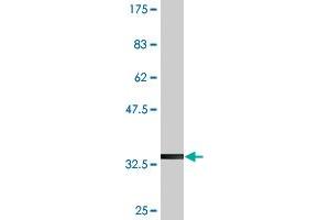 Western Blot detection against Immunogen (36. (NETO2 antibody  (AA 426-525))