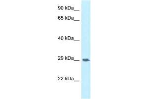 WB Suggested Anti-SIRPG Antibody Titration: 1. (SIRPG antibody  (Middle Region))