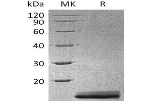 Western Blotting (WB) image for Anterior Gradient 3 (AGR3) protein (His tag) (ABIN7320852)