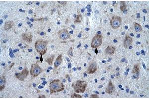 Immunohistochemical staining (Formalin-fixed paraffin-embedded sections) of human brain with KCTD13 polyclonal antibody . (KCTD13 antibody  (AA 26-75))