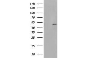 Image no. 1 for anti-phosphorylase Kinase, gamma 2 (Testis) (PHKG2) (AA 1-216) antibody (ABIN1490613) (PHKG2 antibody  (AA 1-216))