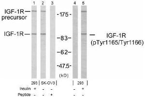 Image no. 1 for anti-Insulin-Like Growth Factor 1 Receptor (IGF1R) (pTyr1165), (pTyr1166) antibody (ABIN197244) (IGF1R antibody  (pTyr1165, pTyr1166))