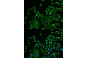 Immunofluorescence (IF) image for anti-LSM4 Homolog, U6 Small Nuclear RNA Associated (LSM4) antibody (ABIN1980258) (LSM4 antibody)