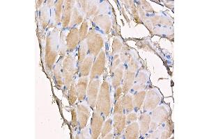 Immunohistochemistry of paraffin-embedded mouse skeletal muscle using MYH4 antibody (ABIN7268749) at dilution of 1:150 (40x lens).