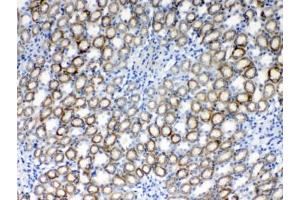 IHC testing of FFPE rat kidney tissue with RPS6 antibody at 1ug/ml. (RPS6 antibody  (AA 13-52))