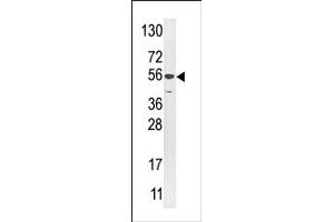 Image no. 1 for anti-Ubiquitin Specific Peptidase 16 (USP16) (N-Term) antibody (ABIN357550) (USP16 antibody  (N-Term))