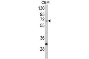 Western blot analysis of ND5 Antibody (C-term) in CEM cell line lysates (35ug/lane). (MT-ND5 antibody  (C-Term))