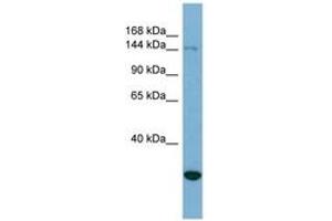 Image no. 1 for anti-Jumonji, AT Rich Interactive Domain 2 (JARID2) (AA 215-264) antibody (ABIN6741955) (JARID2 antibody  (AA 215-264))