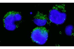 anti-Breakpoint Cluster Region (BCR) (AA 1221-1271) antibody